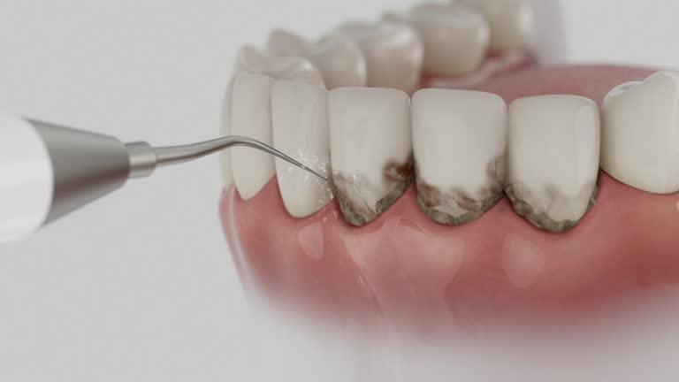 Reliable Emergency Dentist contractor in Lacon, IL by Smile Center Dentistry